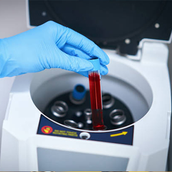 acceleration and speed calibration in coimbatore