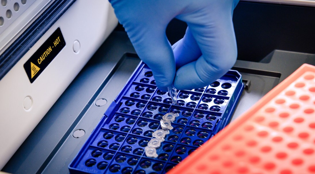 elisa reader machine in coimbatore laboratory elisa analyzer plate reader system